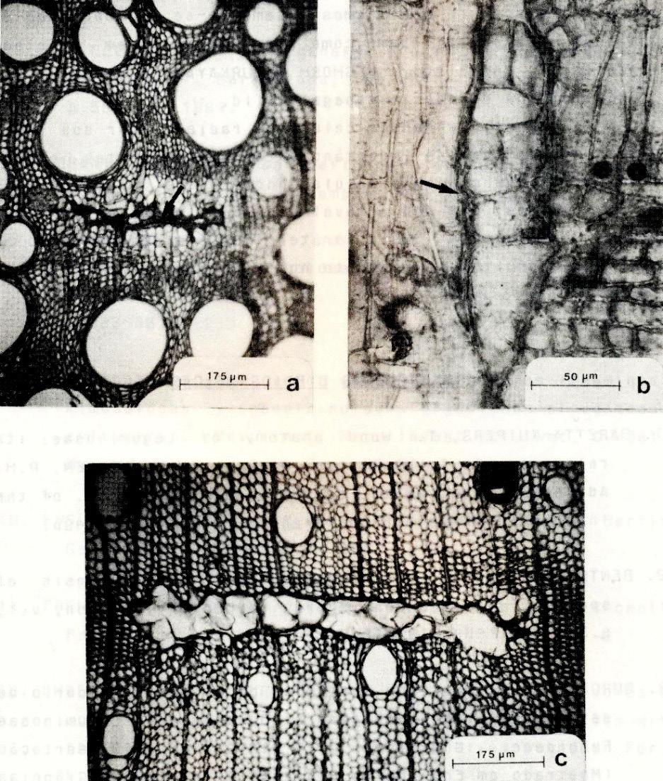 Anatomia da madeira de Acacia nitidifolia Speg. (Leguminosae... 59 FIGURA 4: A. Secção transversal, mostrando canal intercelular axial preenchido de resina (seta), associado a uma mácula medular. B.