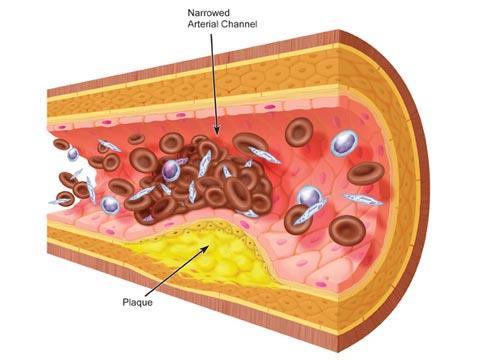 Esteroides: Colesterol É transportado pela sangue na forma de LDL (lipoproteína de baixa densidade); Em