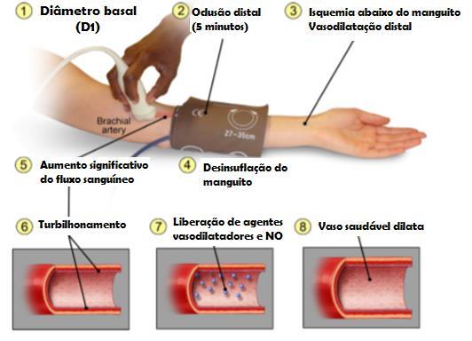 48 corresponde ao fim da diástole cardíaca, e a melhor imagem foi obtida através do resgate pelo cine loop do equipamento.