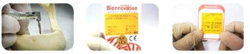 perfuração e instalação recomendada para o Sistema de Implantes Biomorse.