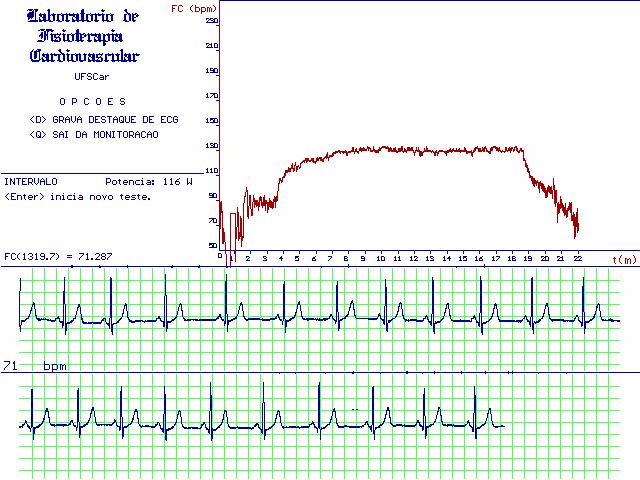 40 Figura 1: Ilustração da tela de aquisição de dados do eletrocardiograma e da freqüência cardíaca, batimento a batimento, obtida a partir dos intervalos R-R de um dos voluntários estudados (4)