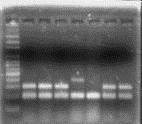 47 5 RESULTADOS 51 IDENTIFICAÇÃO MOLECULAR DE Salmonella A FIGURA 4 sintetiza os resultados obtidos nas reações de PCR para identificação de bactérias do gênero Salmonella e dos sorotipos Enteritidis