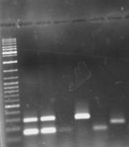 56 FIGURA 9 PERFIS REPRESENTATIVOS DA PCR TRIPLEX PARA DETERMINAÇÃO DO GRUPO FILOGENÉTICO OBSERVADOS PARA DEC A M 2 3 4 5 6 7 B M 2 3 1000 pb 1000 pb 500 pb 500 pb 100 pb 100 pb FONTE: O autor (2016)