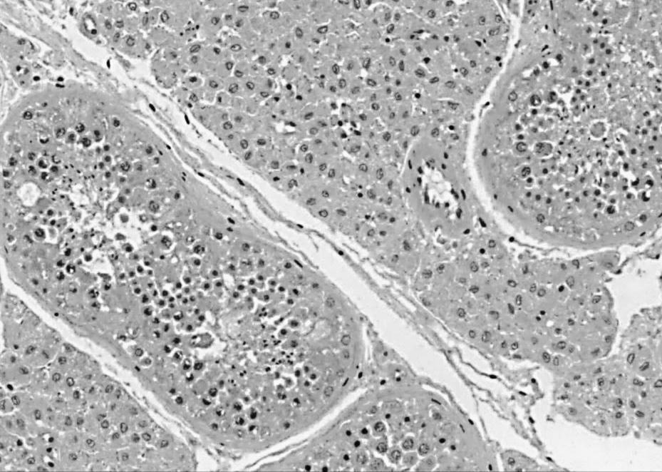 25 µm EV CL TS VS EL Figura : Componentes do parênquima testicular de paca: túbulo seminífero (TS), células de Leydig (CL), endotélio visceral da célula de célula de