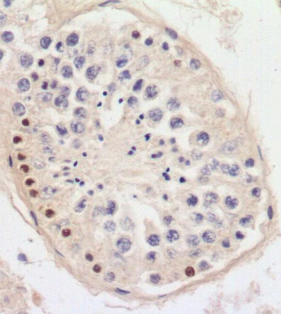 espermatócitos primários em paquíteno após dias de aplicação do BrdU.