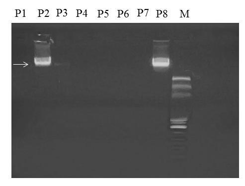10 Para visualização dos resultados da PCR foi novamente utilizada a metodologia de Kanbe et al. (2002). Todos os ensaios de eletroforese foram registrados em fotos e tratados com o software ImageJ.