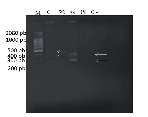12 de PCR multiplex o controle positivo foi composto pelas espécies C. glabrata (423 pb) e C. krusei (362 pb). Figura 3.