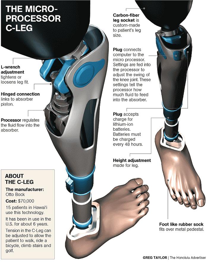 Otto Bock C-Leg: joelho com controle de movimento na fase de swing e controle de impedância na fase de suporte.