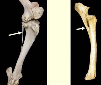 cartilagem entre os ossos