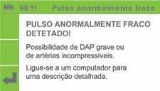 Na maioria dos casos, o resultado Pulso anormalmente fraco corresponde a um paciente com Índice Pressórico Tornozelo-Braquial de 0,5 ou menor.