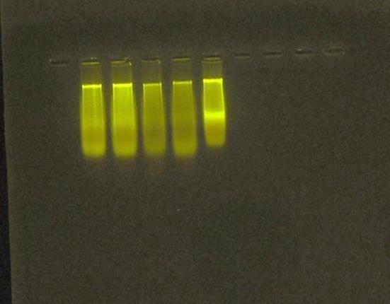 Logo após, foi realizada a reação PCR especifico utilizando os marcadores moleculares PAL1v1978 e PAR1c496,