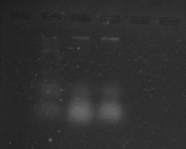 Figura 7: Amplificação de DNA via PCR quantificado em gel de agarose.
