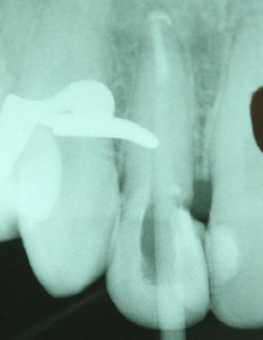 Figura 03 - Pormenor dos dentes anteriores
