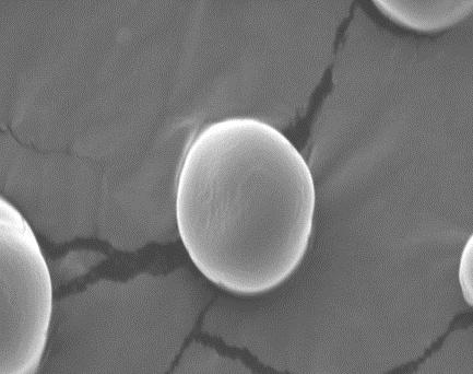 Figura 1 - Micrografias das microcápsulas de Bifidobacterium BB-12 com leite