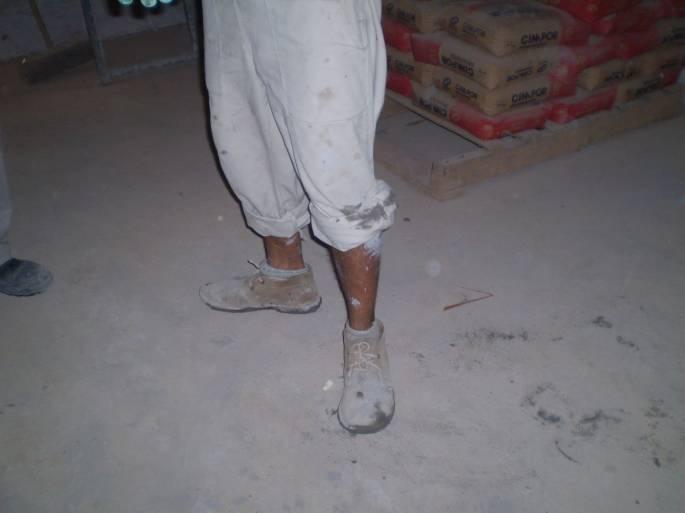 Trabalhador sem o calçado de segurança e, o calçado utilizado estava rasgado.