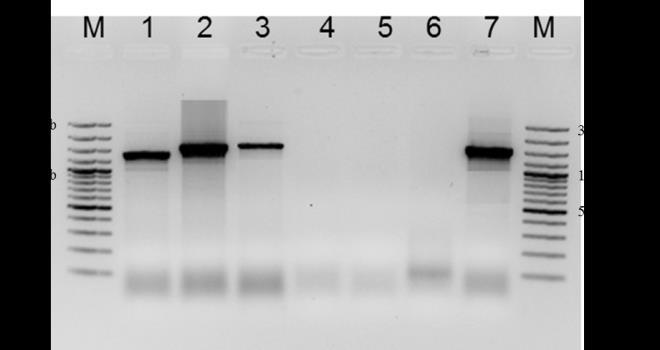 56 Figura 9. Gel de agarose com amplificação da associação entre os genes inti1 e aac(6 )- Ib-cr.
