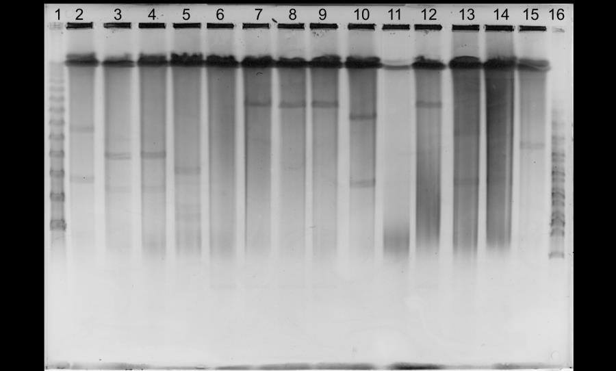 Figura 14. Gel de agarose de eletroforese em campo pulsado após digestão com S1 nuclease.