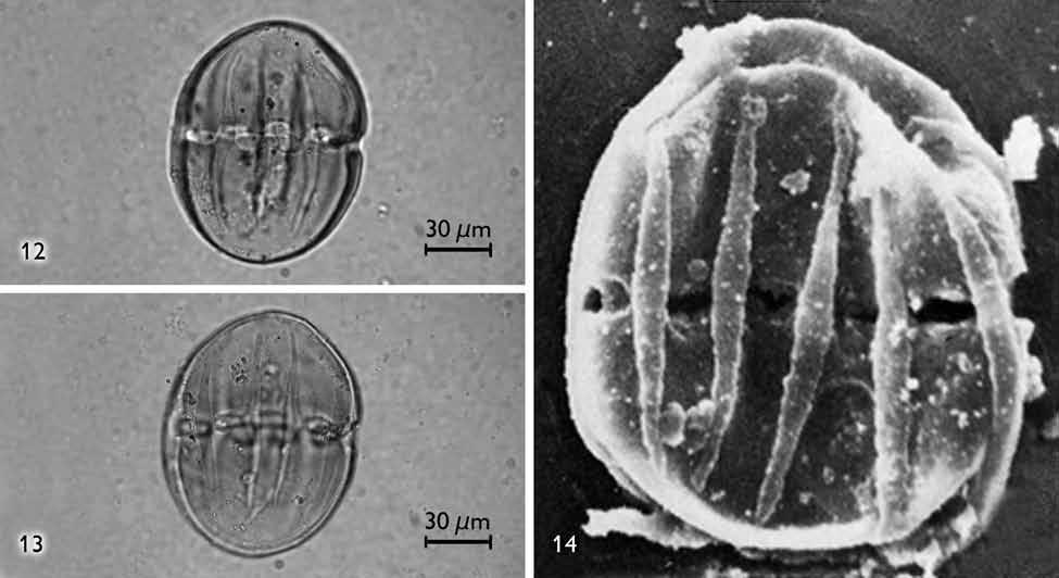 Microscopia eletrônica de varredura (MEV): 11) VE, aspecto dos cólporos e da superfície perfurada (Fonte: Gama, T., 2010). Figura 5.