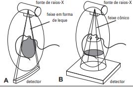 Figura XII: Comparação gráfica da tomografia convencional (A) e da tomografia computorizada de feixe cónico (B) com a fonte e detector de raios-x (Adaptado de:garib 2007) (22) 2.