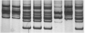 Resultados A caracterização dos clones remanescentes no baço dos animais infectados com a mistura OPS21 cl11 + P209 cl1 (100% susceptível + 0% susceptível), revelou a presença do OPS21 cl11, ou seja,