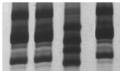 Resultados IT1 IT2 SO3 cl5 P209 cl1 Figura 15: Perfil de LSSP-PCR representativo dos resultados obtidos da identificação de clones presentes nos tecidos de animais infectados com a mistura P209 cl1 +