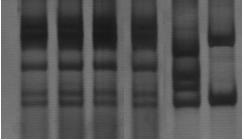 Resultados não foi definida (Tabela VI). O perfil de LSSP-PCR obtido dessa caracterização está representado na Figura 17.