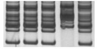 O perfil de LSSP-PCR obtido na identificação dos clones presentes nos tecidos de animais infectados com a mistura OPS21 cl11 + P209 cl1 está representado na Figura 18.