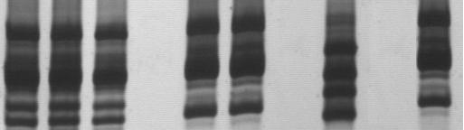 D Figura 18: Perfil de LSSP-PCR representativo dos resultados obtidos de isolados de animais infectados com diferentes combinações genotípicas do Trypanosoma cruzi e que