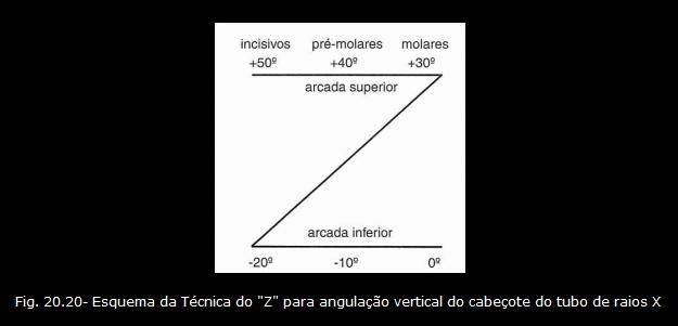 20 Posicionamentos da cabeça do paciente- cabeçote o