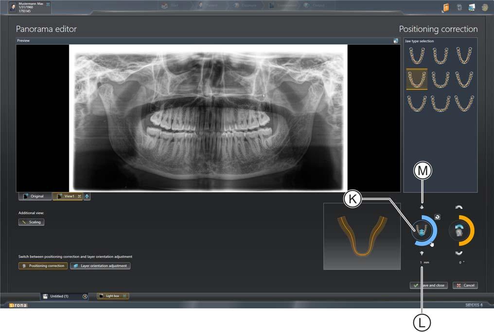 Sirona Dental Systems GmbH Adenda ao "Manual do usuário do SIDEXIS 4" SIDEXIS 4 3 Controle do editor de panorâmicas 3.2 