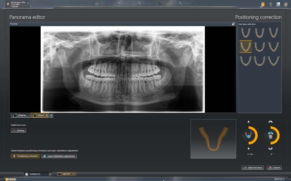 3 Controle do editor de panorâmicas Sirona Dental Systems GmbH 3.