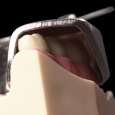 Já na mandíbula, um tamanho de moldeira menor pode ser mais vantajoso, já que as retenções são