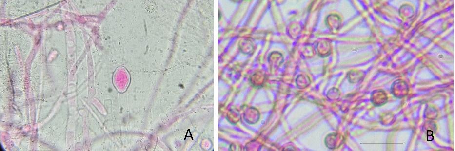 As culturas apresentavam hifas generativas de septo simples (diâmetro variando entre 4 e 12µm, mais abundantes no micélio aéreo.