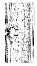 Figura 2. Vagina menor que a metade da largura corporal e com peças esclerotizadas delicadas, pouco visíveis, em Paratrichodorus (foto ao alto) vs.