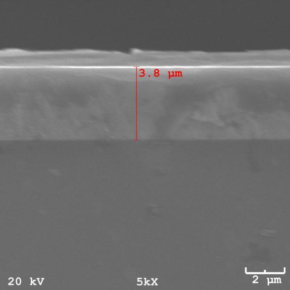 9 Imagem de MEV para a amostra 5 com aumento de 5000X.