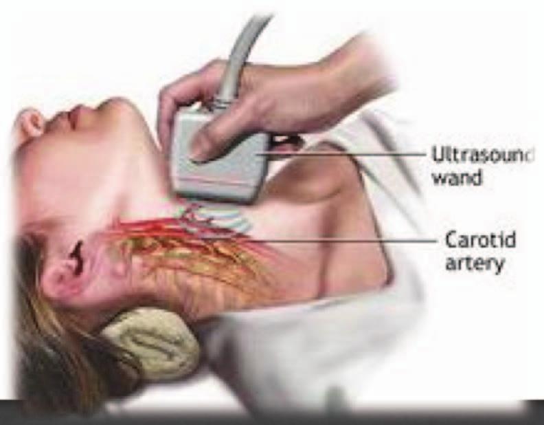 - Criança em decúbito dorsal IMT - Ecógrafo com transdutor de alta resolução (até 13 MHz) - A sonda é