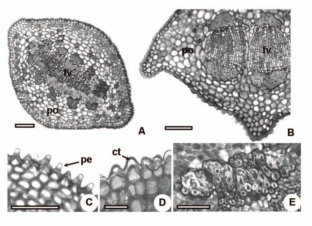 P. mucronatum; C. Detalhe da epiderme de P. mucronatum; D. Detalhe da epiderme de P. linearifolium; E. Detalhe de um grande grupo de braquiesclereídes de P.
