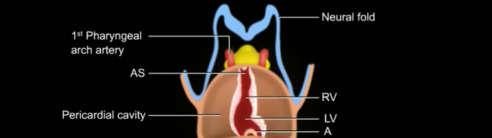 NORMAL T: Tronco arterioso B: