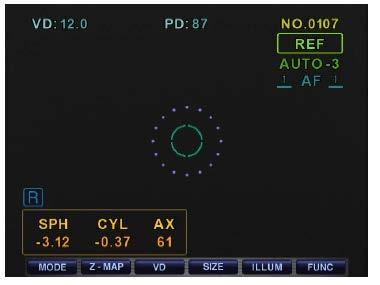 30 Auto - Auto refrator/ceratômetro ERK-9100----------------------------------------------------- 8.1.2 Modo de medição automática Ao pressionar o botão Auto no Modo de medição manual, ele automaticamente altera para o modo de medição automático.