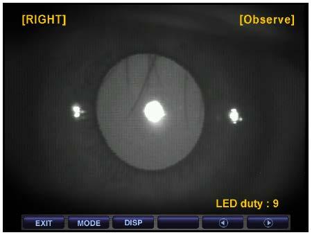44 Auto - Auto refrator/ceratômetro ERK-9100----------------------------------------------------- - Examine o grau de opacidade do cristalino com a forma de luz refletida da retina ao alterar a