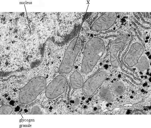 nucleus X glycogen granule i) De que tipo de célula se trata? Justifique a sua resposta Célula eucariota animal (presença de núcleo, mitocôndrias e glicogénio) ii) Qual a denominação do organito X?