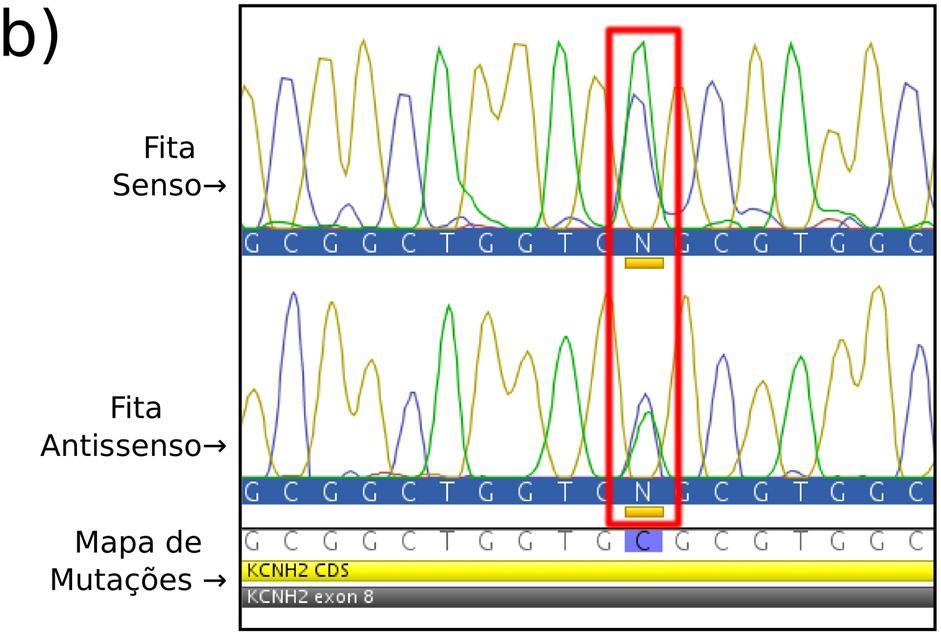 As fitas senso e antissenso e o mapa de mutações estão indicados. a) Família A - a variante A1692G está destacada por um retângulo azul e a variante G1714A por um retângulo vermelho.