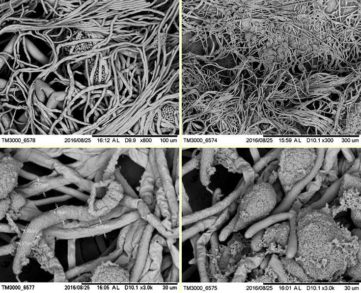 78 Nas micrografias eletrônicas de varredura referentes à interação do fungo A. nomius (ENT22) com o mutualista L. gongylophorus (FF2006), também não foram observadas estruturas especializadas.