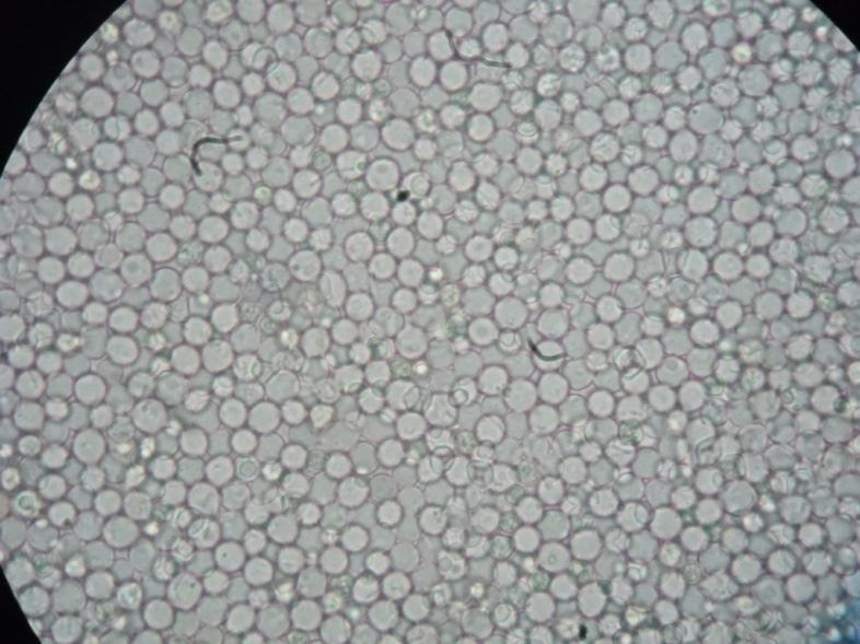 34 Foto 2.2 - Células floculantes de Saccharomyces cerevisiae da Unidade Catanduva em microscopia, safra 2012 (Fonte: Acervo pessoal) Foto 2.
