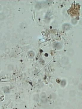 DECOMPOSIÇÃO DA FOLHADA QUE CAI NOS RIOS A abrasão física, as bactérias e os invertebrados reduzem a matéria orgânica grosseira CPOM a fina FPOM Uma parte deste carbono junta-se aos excretados e