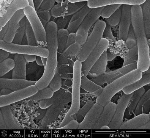 Nanotubos de Carbono (CNT) Bactérias Methanobacterium