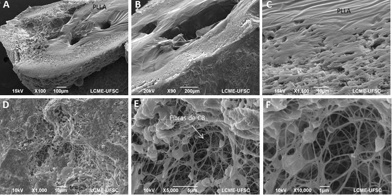Pode-se visualizar que a superfície é mais densa num dos lados e que em ambos os casos as fibras de celulose ficaram bem distribuídas no biocompósito.