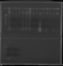 Identificação pelo gene 16S DNAr Em relação aos processos de caracterização pela técnica de biologia molecular, através da extração de DNA, a mesma foi efetuada com sucesso mostrando o perfil de