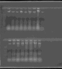 Para identificar todos os isolados, é necessária a amplificação do material genético de cada isolado pela técnica de PCR e enviar as amostras para sequenciamento o qual identificará especificadamente