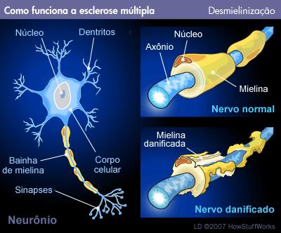 4.3 Lipídeos conjugados 4.3.2 Esfingolipídeos Esfingomielina; Bainha de mielina